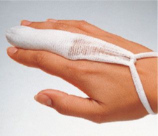 Bandage rapide pour doigt Leina